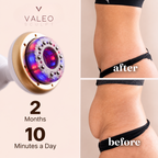 Valeo Sculpt Contour™ CS-1