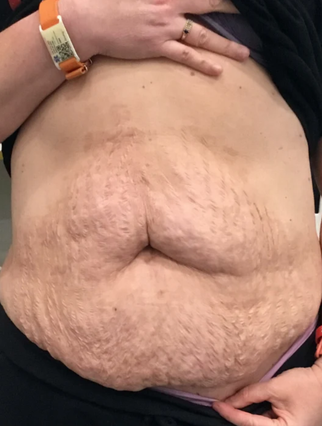 Kassandra J. before using Firm