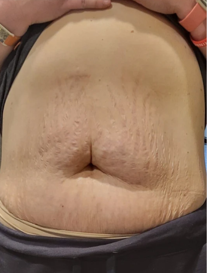 Kassandra J. after using Firm