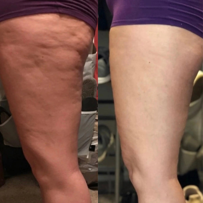 Valeo Sculpt Contour CS-1 results photo 6